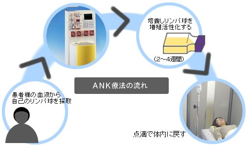 ＡＮＫ免疫細胞療法
