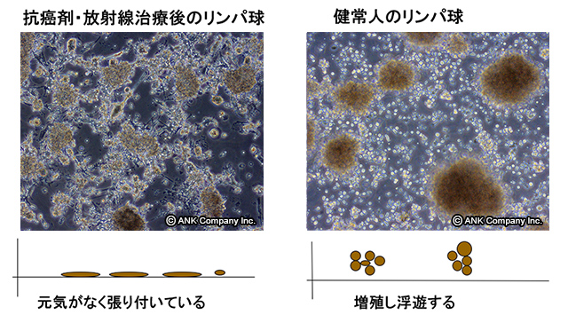 抗癌剤・放射線治療後のリンパ球と健常人のリンパ球